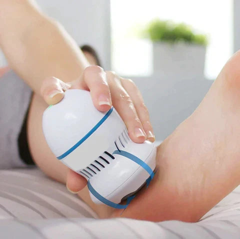 Trendiko Electric Foot Callus Remover