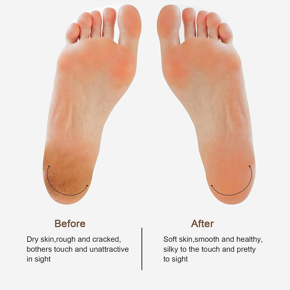 Rechargeable electric foot file